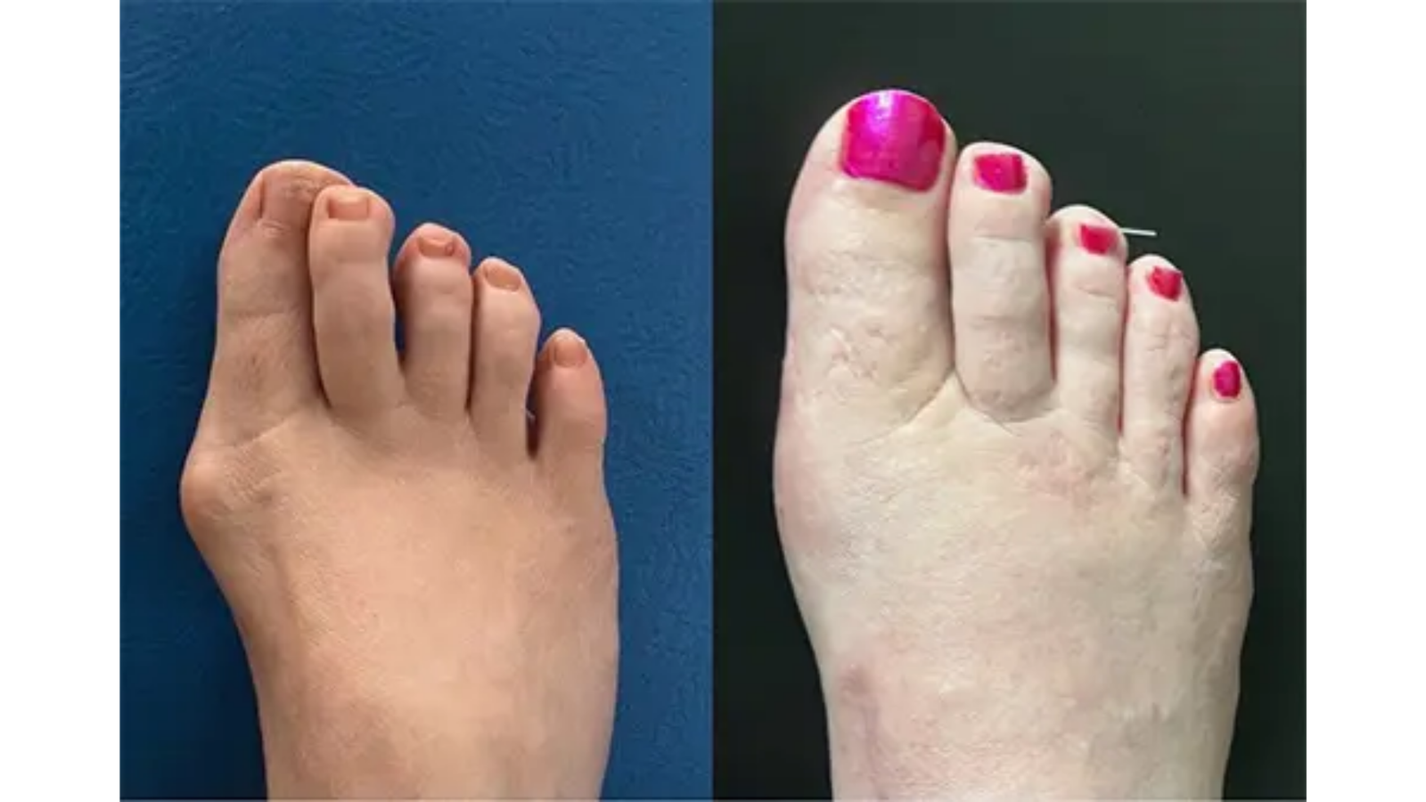 Antes e depois